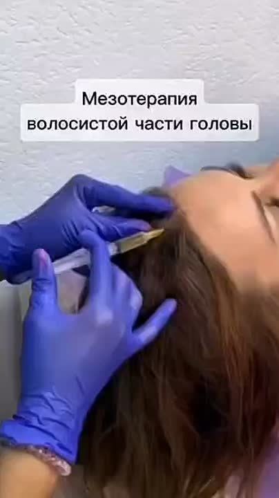 Мезотерапия волос летом — спасение от агрессивного солнца и не только!