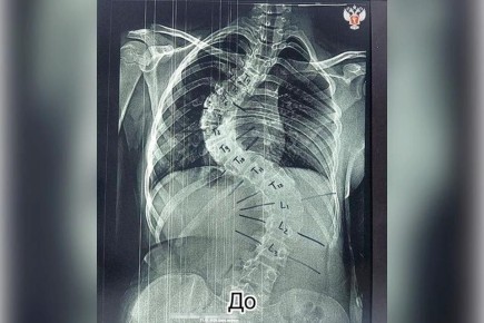   ,    : 13-   