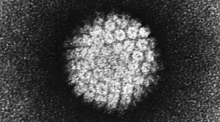 Вирус папилломы уходит в прошлое