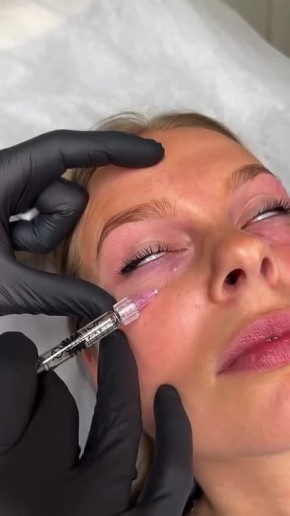 МОЖНО ЛИ ИЗБАВИТЬСЯ ОТ МОРЩИН БЕЗ ИНЪЕКЦИЙ, ЕСЛИ ВАМ 45+ ЛЕТ?