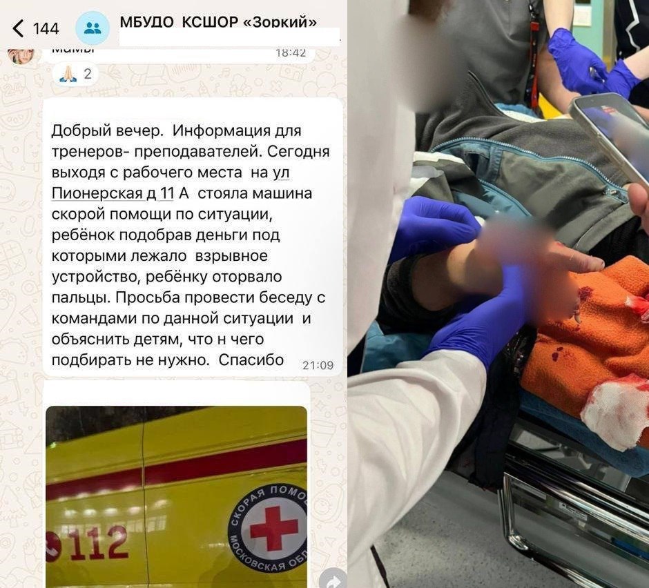 10-летнему мальчику разорвало кисть после того, как он поднял на улице деньги в подмосковном Красногорске