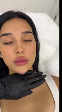 311111164. Приём ведёт команда специалистов с медицинским образованием в области косметологии прием будет проводиться 9 декабря