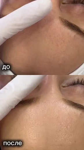 311111164. Приём ведёт команда специалистов с медицинским образованием в области косметологии прием будет проводиться 9 декабря