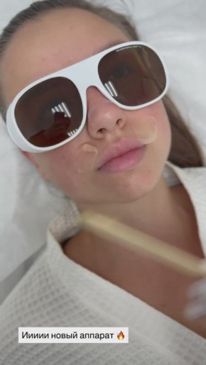 Лазерная эпиляция – гладкость, о которой вы мечтали!