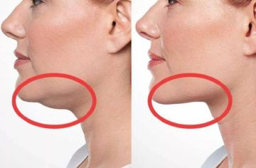 8. Приём ведёт команда специалистов с медицинским образованием в области косметологии прием будет проводиться 8 января