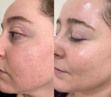 311111164. ��������������� RF-������� � ����� ���� ����� �������� �������