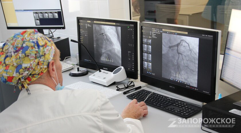 В сосудистых центрах Запорожской области в 2025 году провели 866 стентирований