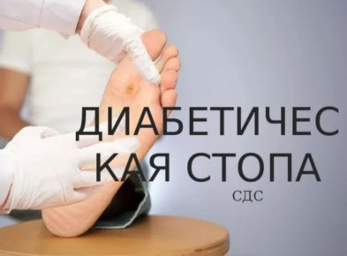 Сахарный диабет и здоровье нижних конечностей: рекомендации по уходу