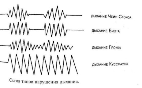 ������������ ��������� �������;