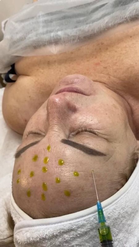 311111165. ����� ����� � ���������� ������� �������� 8 ����� ������ �� ���������� ������ (Wow-������) BioRePeel: ������ ��� ��������!