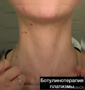 311111165. �������� ������������� ��������� ������� ���������� �������� � ��������� � ������������ ����, ������� ��������� ������ ��� � �������� ���� ����