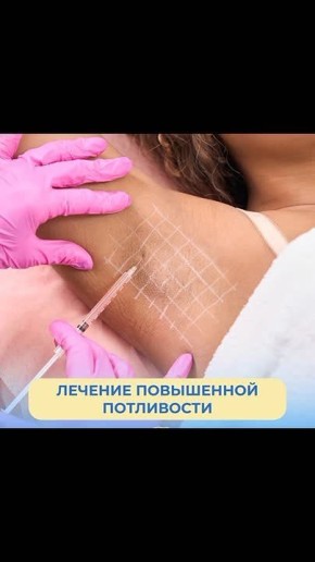 311111165. Сухие подмышки и никаких пятен на одежде возможно? Конечно!!! Ботулинотерапия два раза в год и просто кайф!!! К лету красотки всегда у меня готовы! 11 Приём ведёт команда специалистов с медицинским образованием...