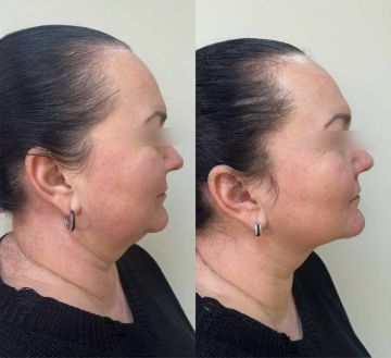 311111165. BioGEL «СТРОЙНОСТЬ»