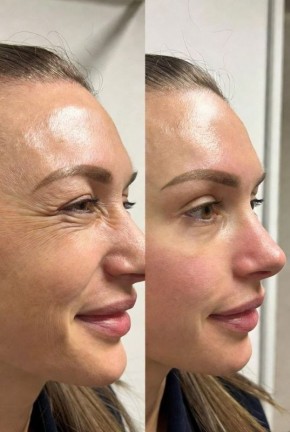 ���� ����������� �� ������