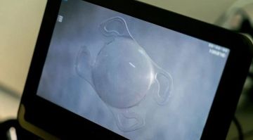 � ������ �������� ������������ ����� ��� ������ ���������� ��� ���������