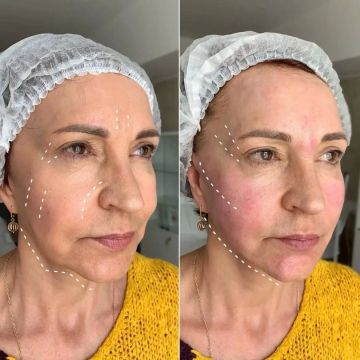 6 ���� � ��� ����������!. ���������� ��� �� ����������������� ����, ������� �������� ����������� � ����������� ������������