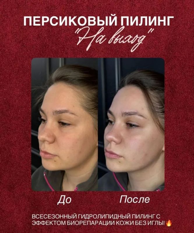 9 августа в пгт Михайловка! 9 августа в пгт Михайловка!