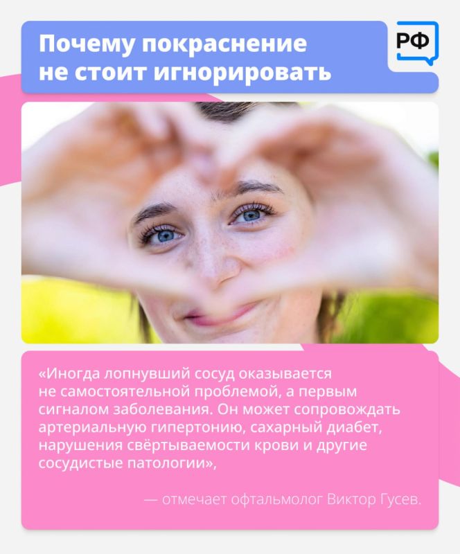 Красные глаза — это красный флаг! Они прямо сигнализируют: пора обратить на них внимание Красные глаза — это красный флаг! Они прямо сигнализируют: пора обратить на них внимание