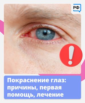 Красные глаза — это красный флаг! Они прямо сигнализируют: пора обратить на них внимание