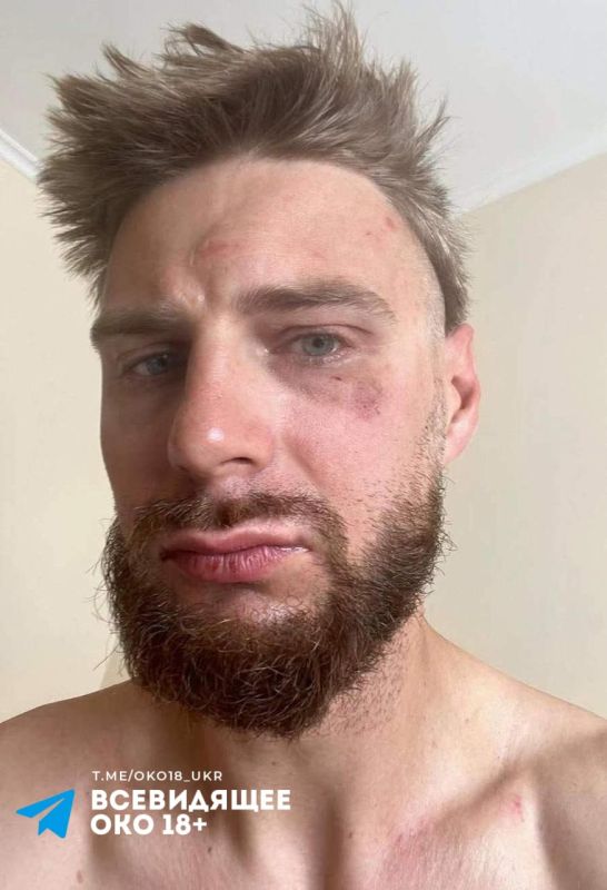 И в Чехии началось.... В Чехии толпа поляков отмудохала польского же волонтёра, принявши его за украинца И в Чехии началось.... В Чехии толпа поляков отмудохала польского же волонтёра, принявши его за украинца